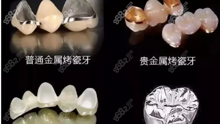 贵金属价格表(贵金属的价格行情)