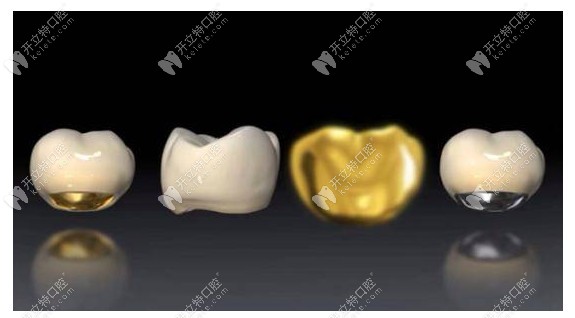 贵金属烤瓷牙的种类(贵金属烤瓷牙的种类图片)
