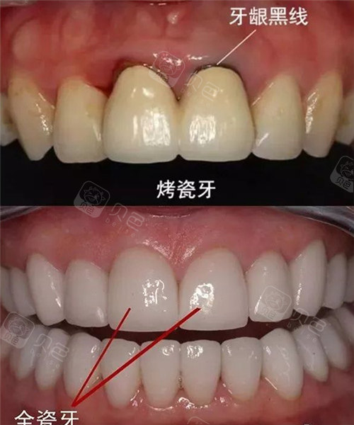 贵金属沉积(贵金属沉积法原理图)
