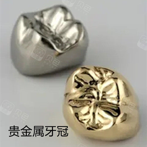 贵金属牙桩(贵金属牙桩价格)